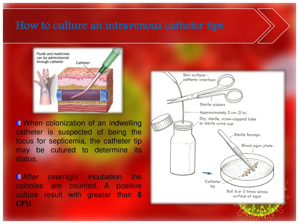 PPT Blood culture PowerPoint Presentation, free download ID390659