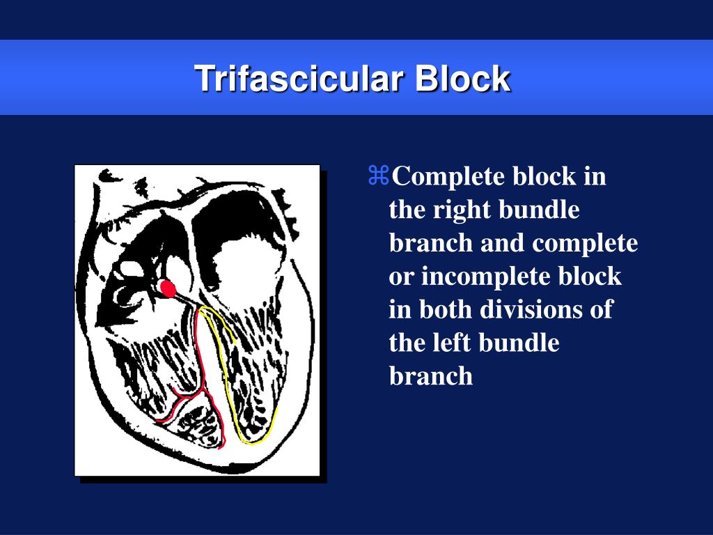 PPT Indications and Mode Selection Part I PowerPoint Presentation