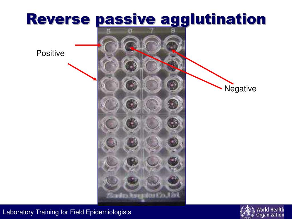 PPT Antigen and antibody detection PowerPoint Presentation, free