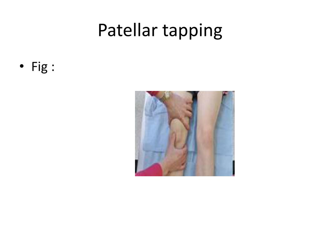 PPT Fracture of the patella PowerPoint Presentation ID394804