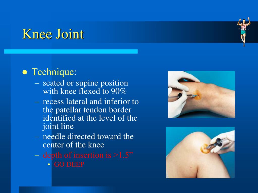 PPT Common Injections for the Family Physician General Principles PowerPoint Presentation