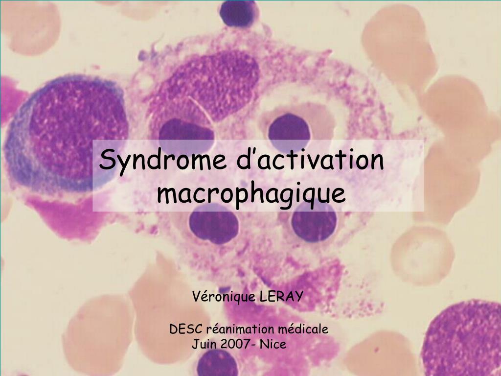 PPT Syndrome d’activation macrophagique PowerPoint Presentation, free