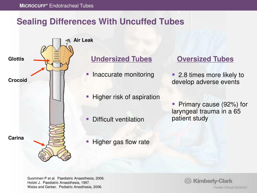 Kimberly Clark Microcuff Endotracheal Tube