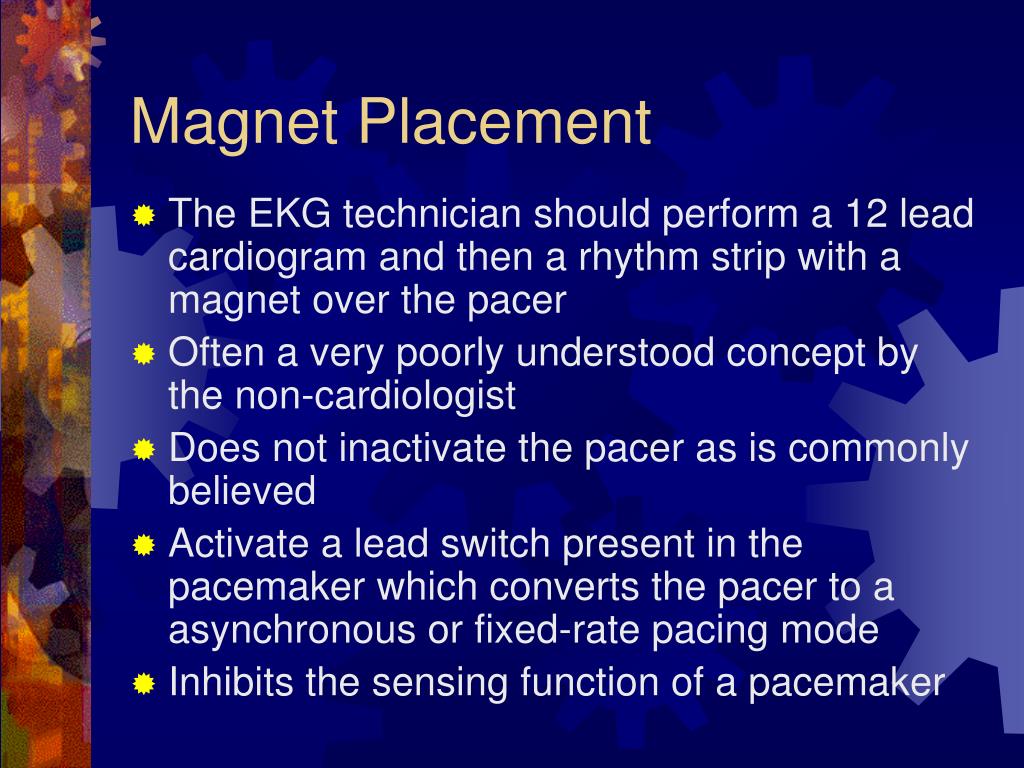 PPT Pacemaker for beginners PowerPoint Presentation, free download
