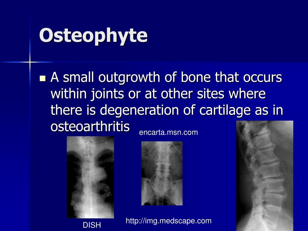 PPT Diagnostic Radiology III Definitions PowerPoint Presentation ID