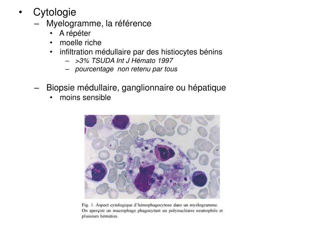 PPT SYNDROME D’ACTIVATION MACROPHAGIQUE PowerPoint Presentation, free