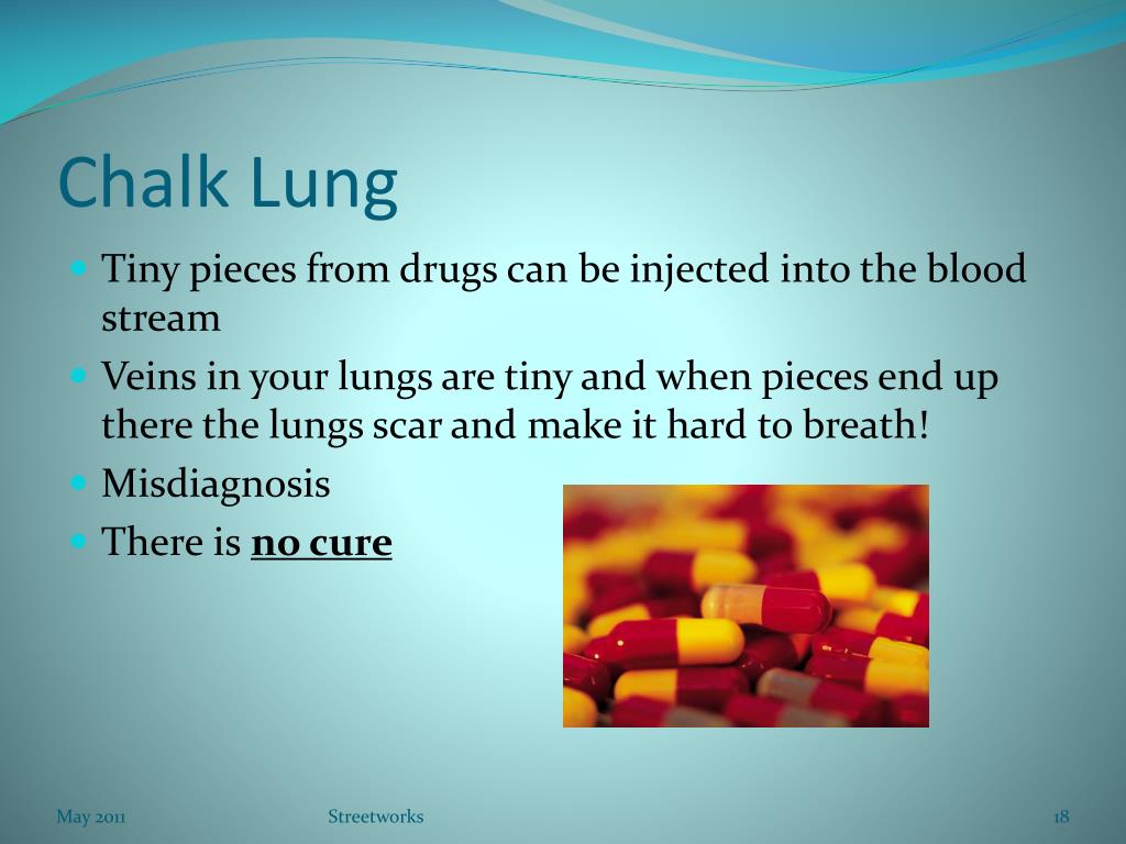 PPT I’m Sick Man; Common Health Issues of People Who Use Drugs