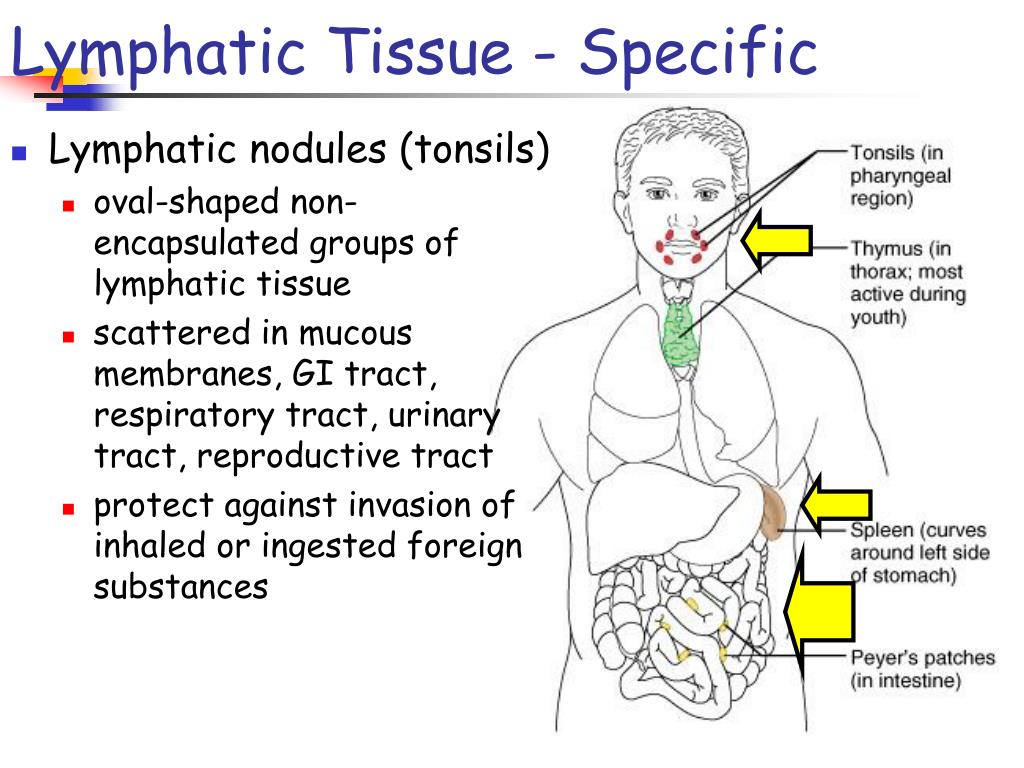 PPT Chapter 22 The Lymphatic and Immune Systems PowerPoint