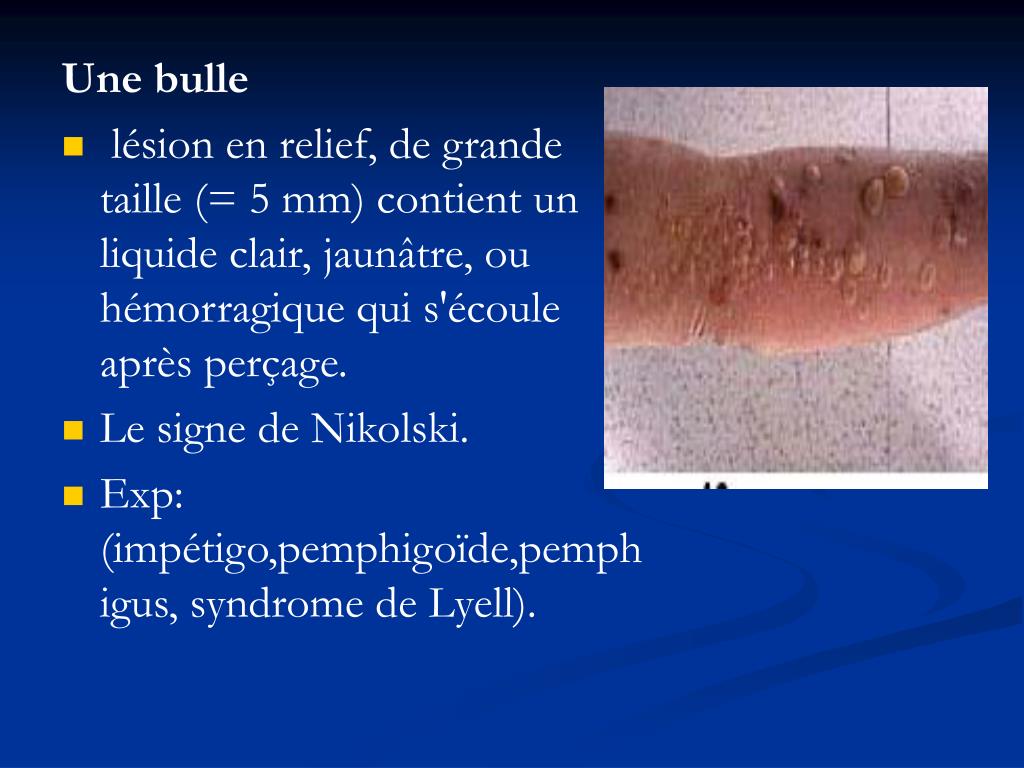 PPT Les lésions élémentaires en dermatologie PowerPoint Presentation
