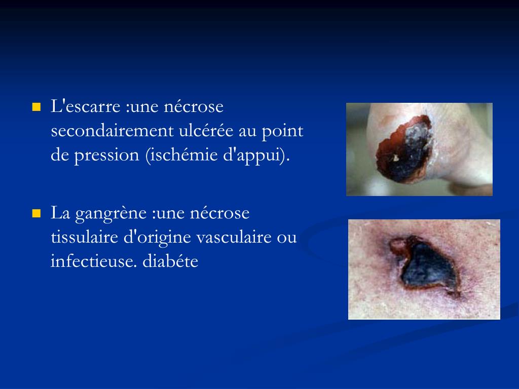 PPT Les lésions élémentaires en dermatologie PowerPoint Presentation