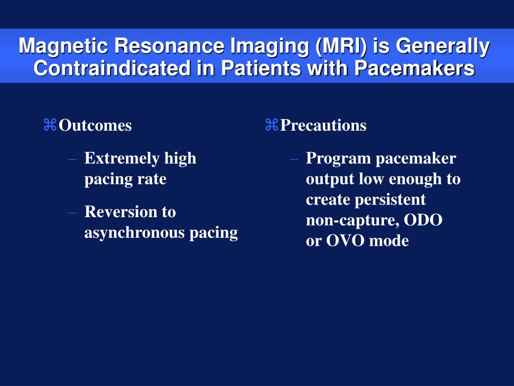 PPT Basic Pacing Concepts Part III PowerPoint Presentation, free download ID429326