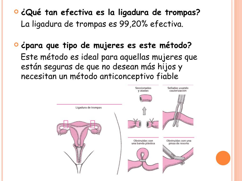 PPT Ligaduras de trompas PowerPoint Presentation, free download ID