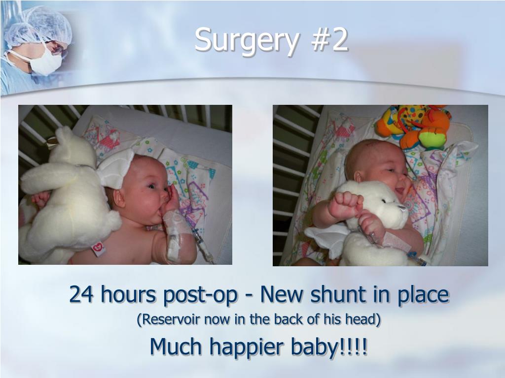 PPT Hydrocephalus & Shunts PowerPoint Presentation ID431868