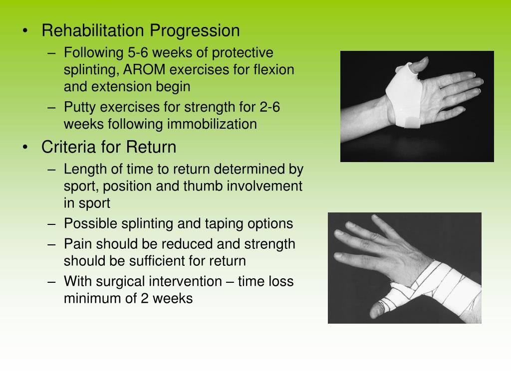 PPT Chapter 20 Rehabilitation of Wrist, Hand and Finger Injuries