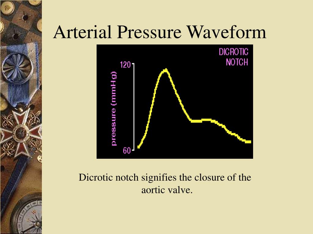 PPT Hemodynamic Monitoring PowerPoint Presentation, free download