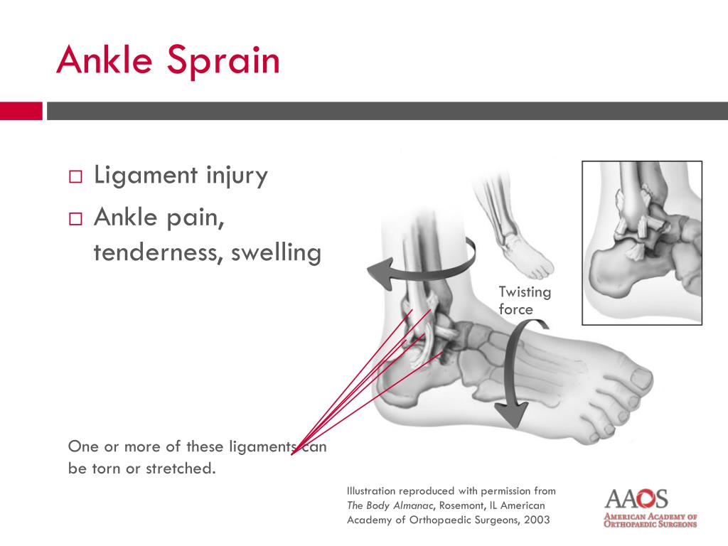 PPT 10 COMMON ORTHOPAEDIC INJURIES PowerPoint Presentation, free