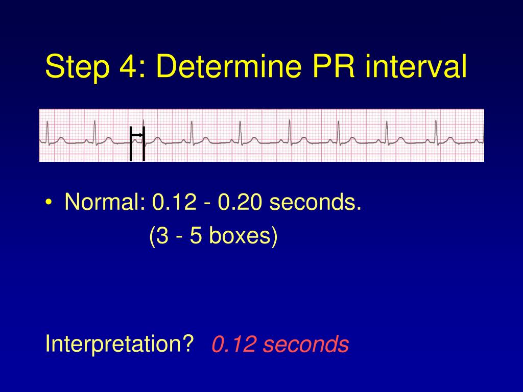 PPT ECG Basics PowerPoint Presentation, free download ID443742