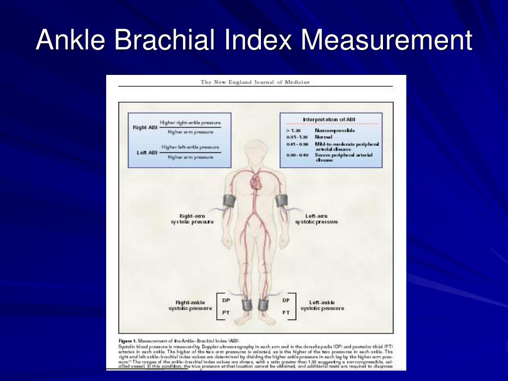 PPT Ankle Brachial Index Measurement What is it and why measure it
