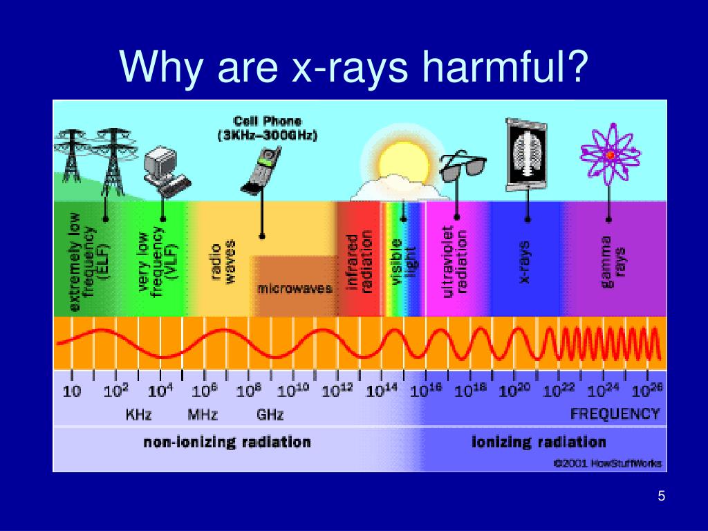 Dangers Of X Rays