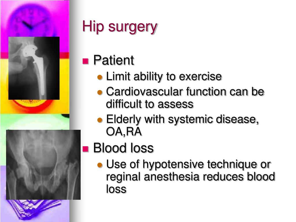 PPT Anesthesia for Orthopedic surgery PowerPoint Presentation, free