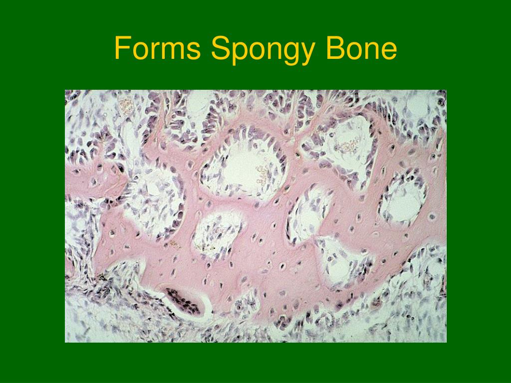 PPT Skeletal System PowerPoint Presentation, free download ID466529