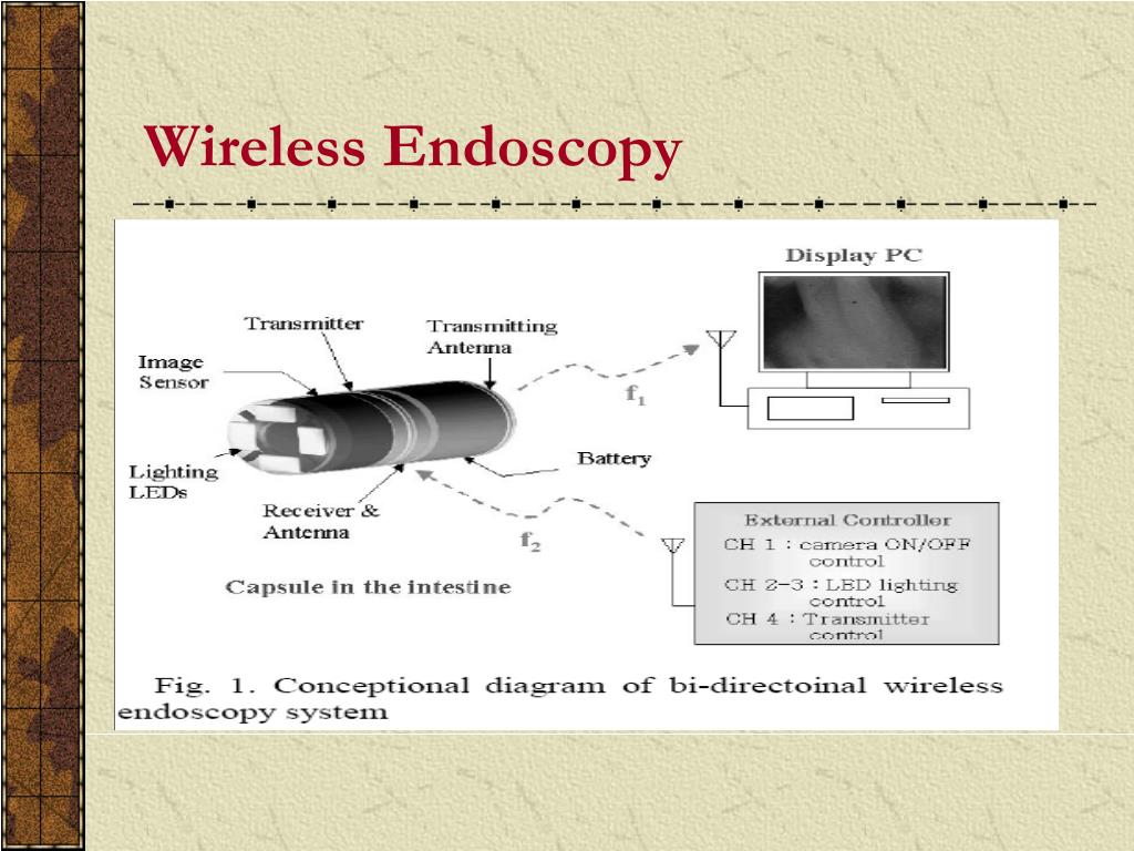 PPT PILL CAMERA PowerPoint Presentation, free download ID468186