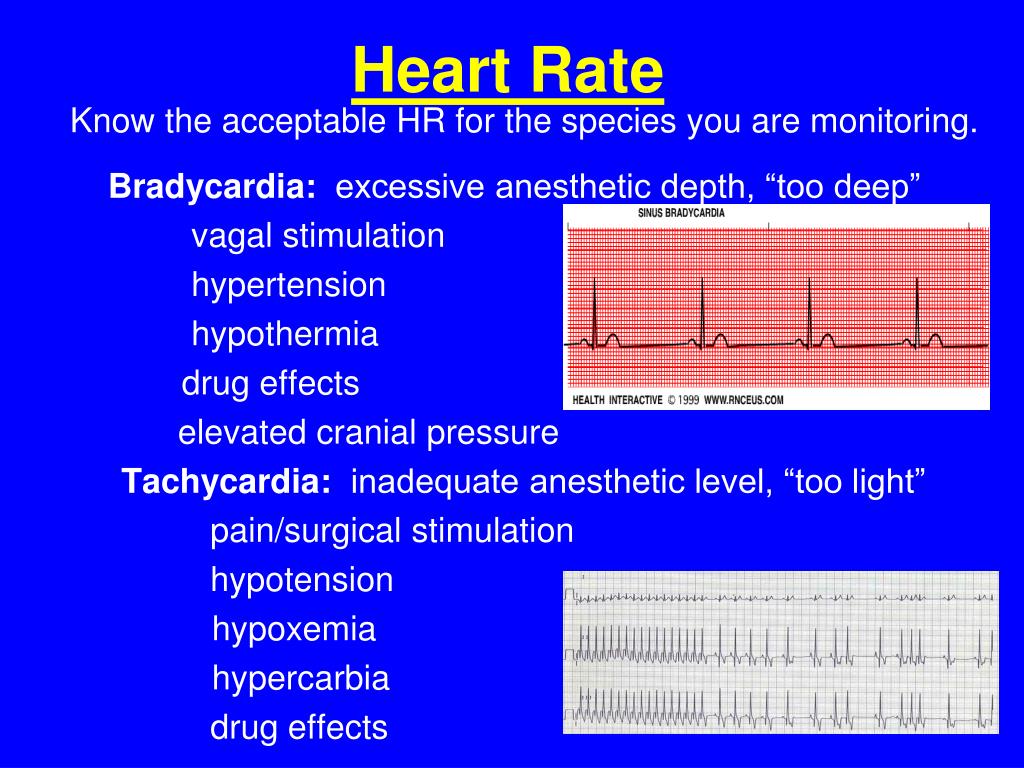 PPT Pre, Peri and PostOperative Care PowerPoint