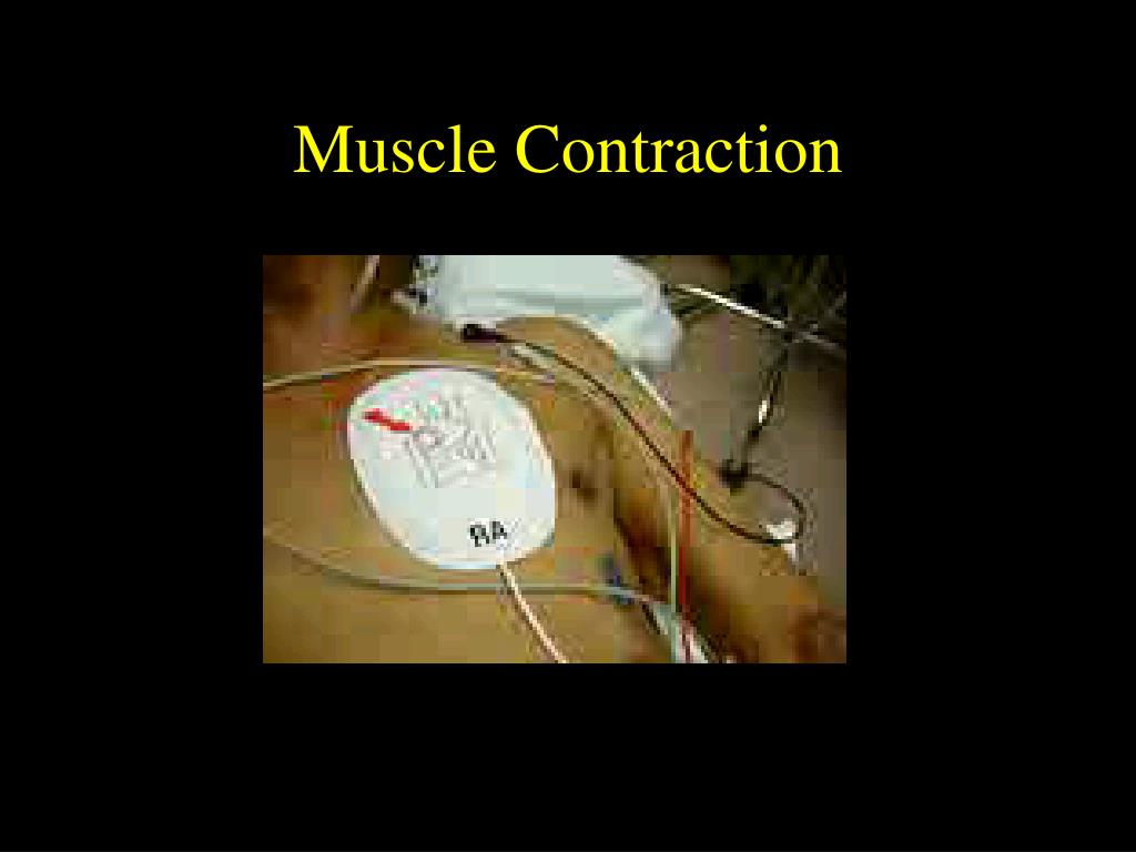 PPT External Cardiac Pacing PowerPoint Presentation ID471279