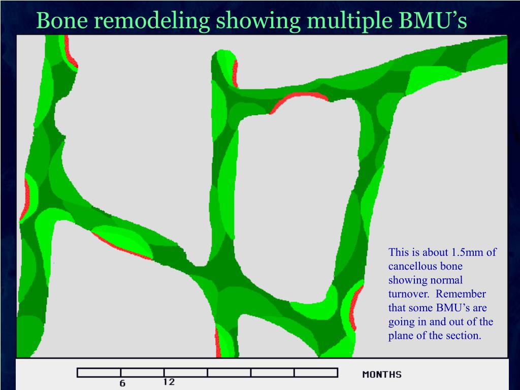 PPT Bone remodeling animations PowerPoint Presentation