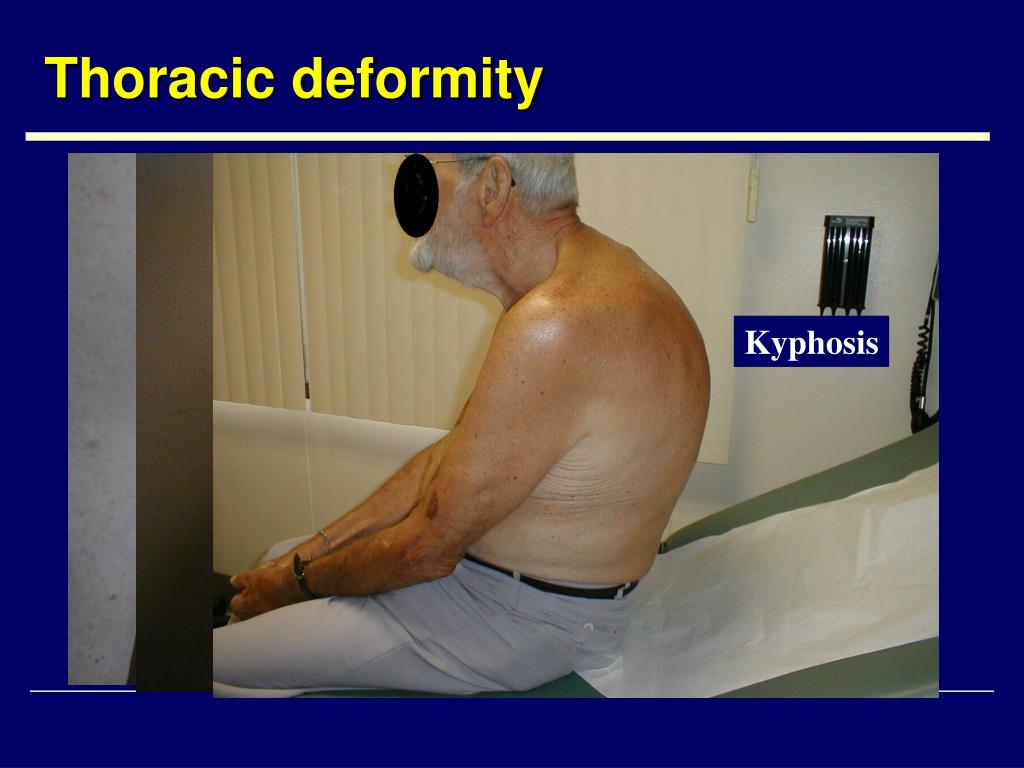 PPT Physical Examination in Respiratory System PowerPoint