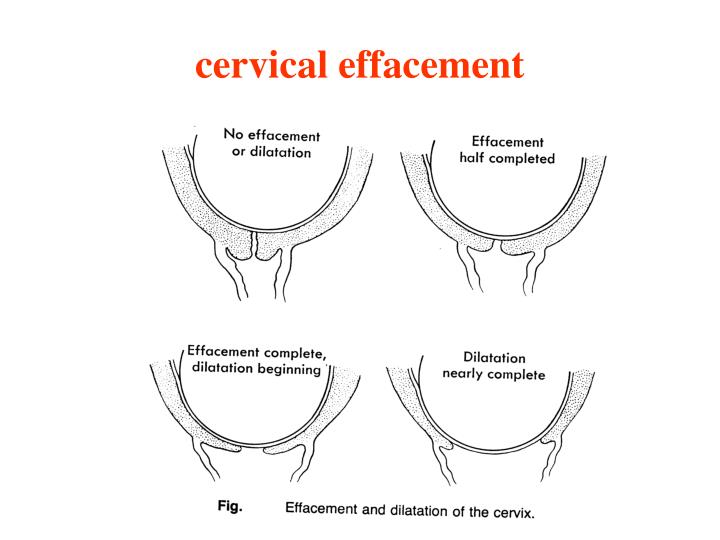PPT Normal labor and delivery PowerPoint Presentation ID475415