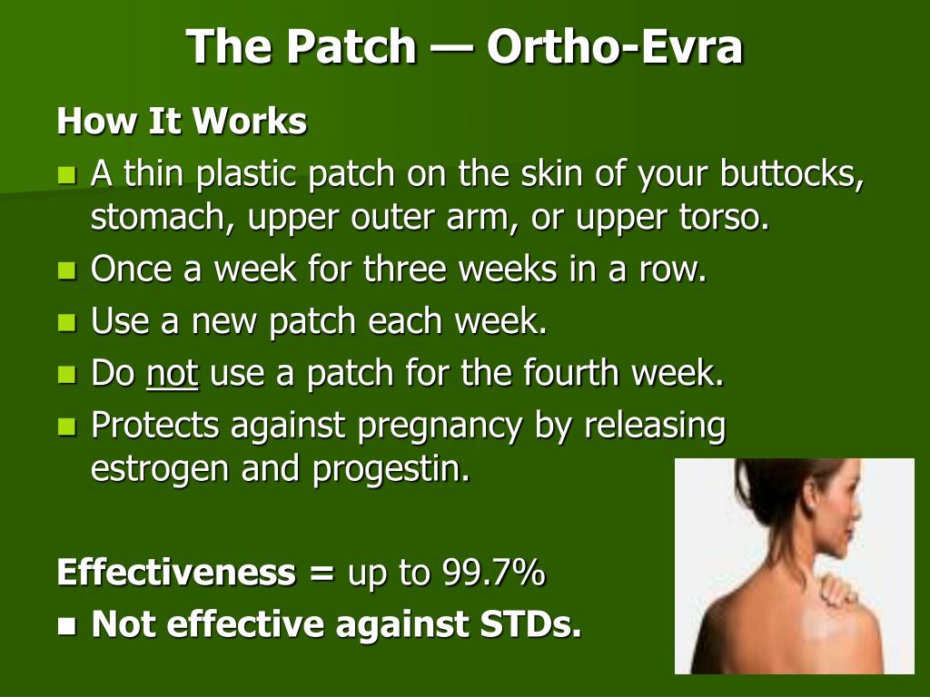 PPT Birth Control For Teens PowerPoint Presentation, free download