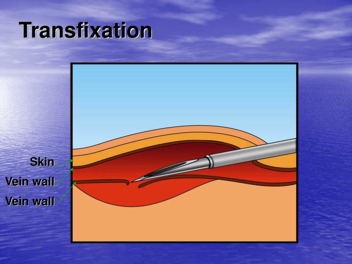 PPT CANNULATION & VENESECTION PowerPoint Presentation ID476990