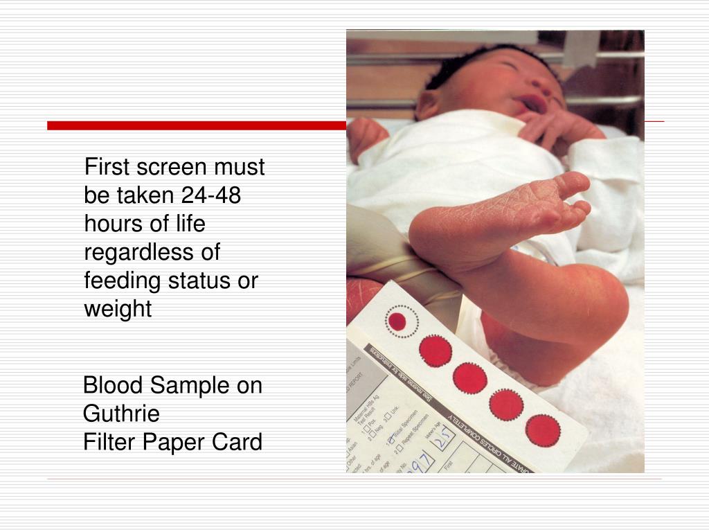 PPT Newborn Screening Historical, Ethical, Technological Aspects