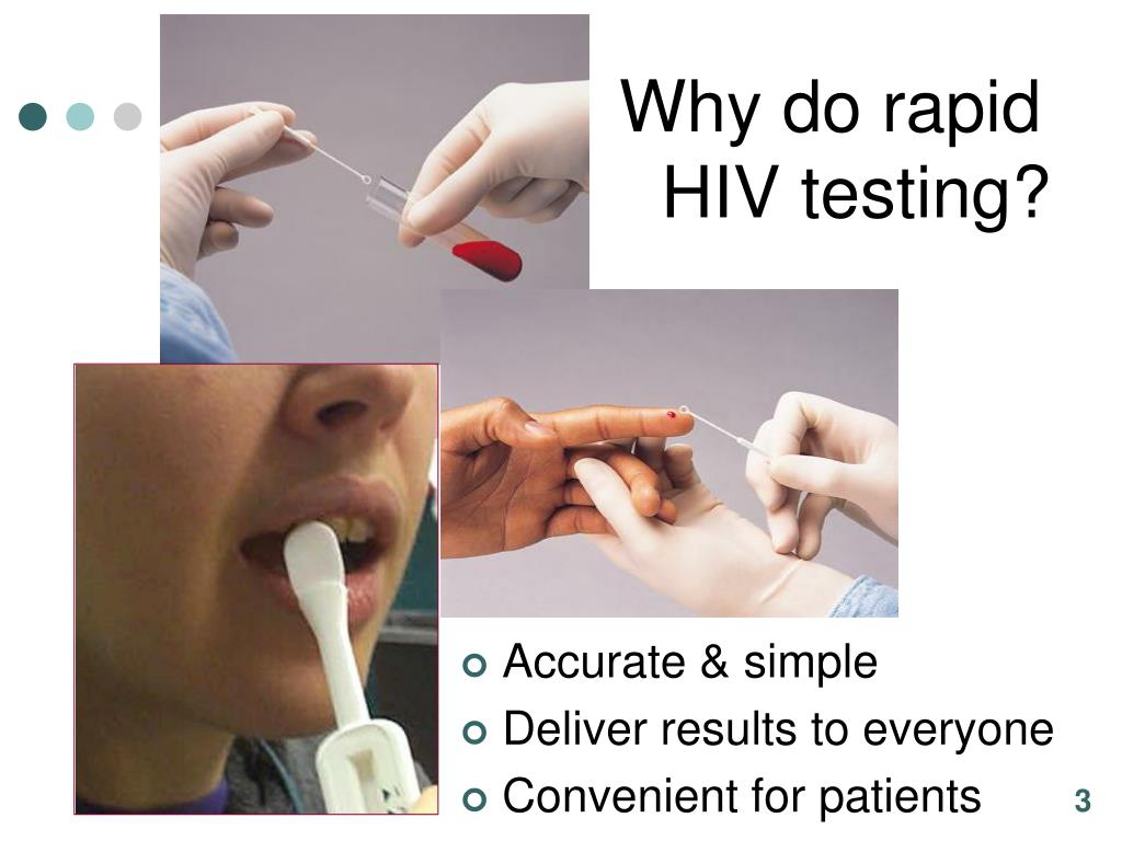 PPT Implementing Rapid HIV Testing Technologies, Legal and Cost