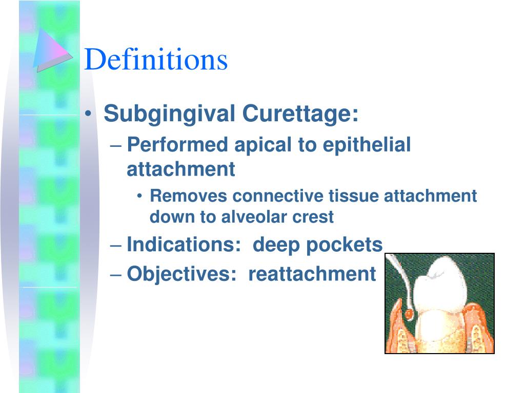 PPT Gingival Curettage PowerPoint Presentation, free download ID479537