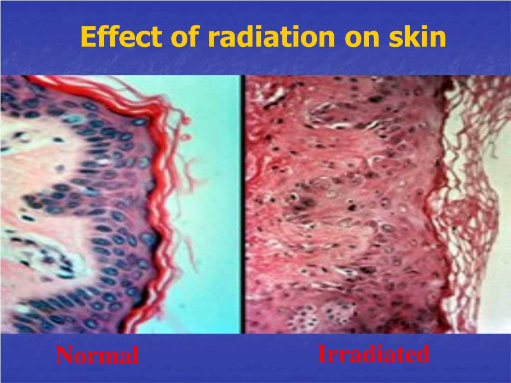 PPT BIOLOGICAL EFFECTS OF IONIZING RADIATION ON T I SSUE S , ORGANS