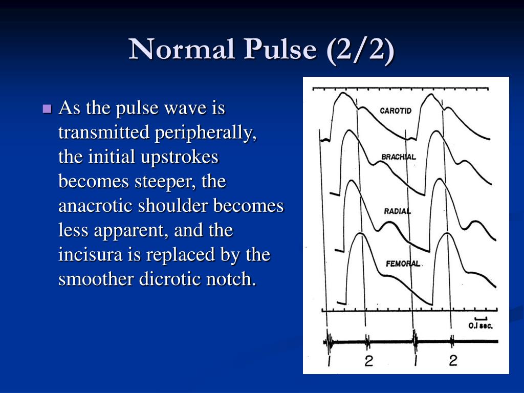 PPT Pulse PowerPoint Presentation, free download ID485278