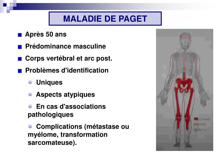 PPT LES TUMEURS PRIMITIVES DU RACHIS PowerPoint