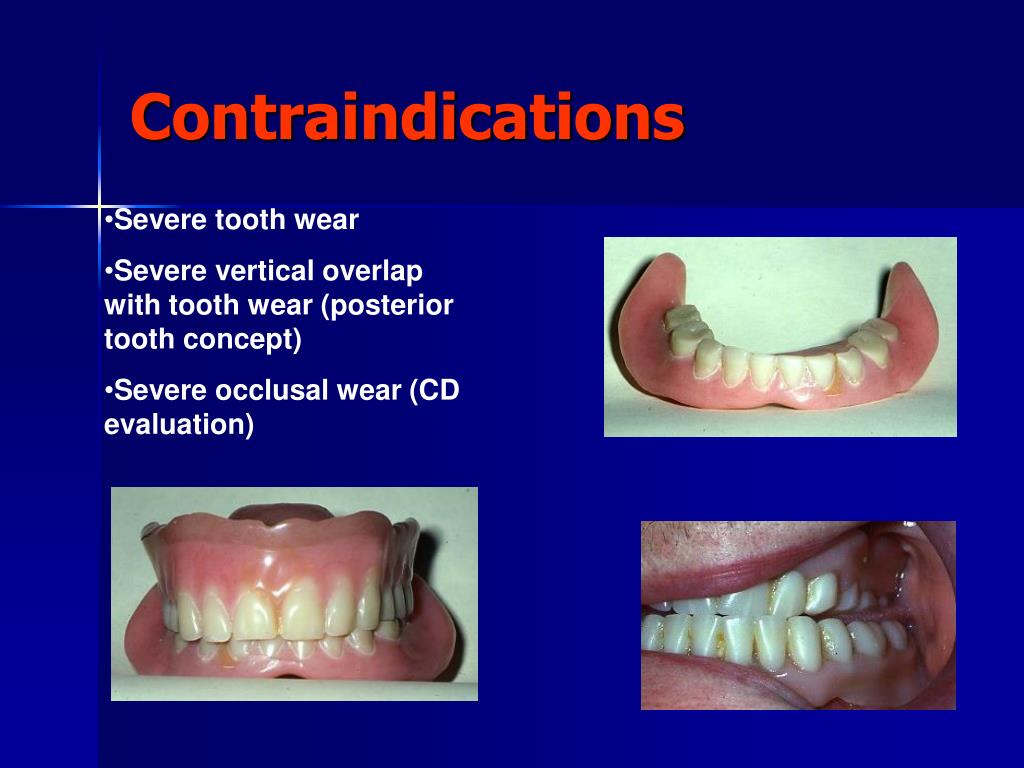 PPT Repair, relining and rebasing PowerPoint Presentation, free