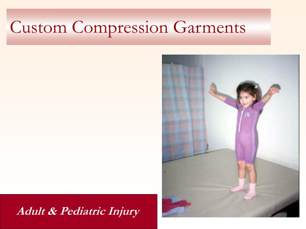 PPT REHABILITATION FOLLOWING A BURN INJURY PowerPoint Presentation