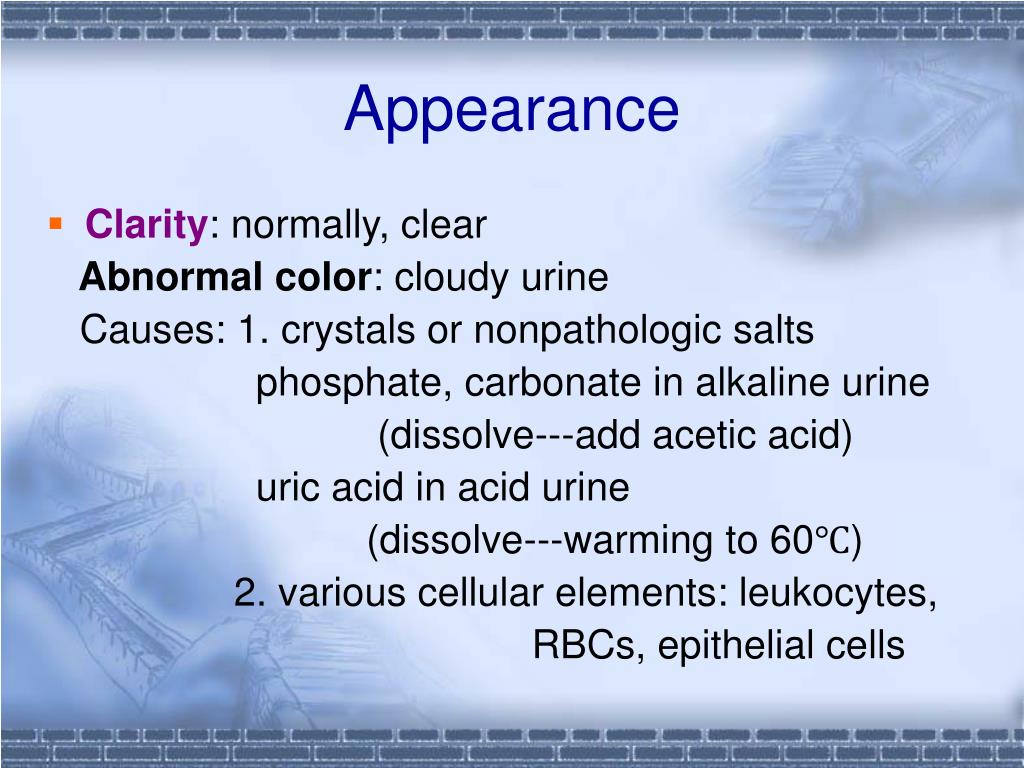 PPT Urinalysis PowerPoint Presentation, free download ID514405