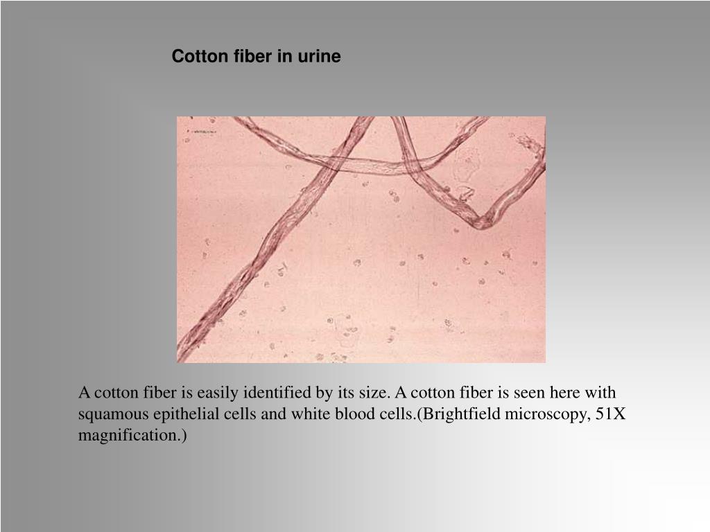 PPT Urine Microscopy PowerPoint Presentation, free download ID518534