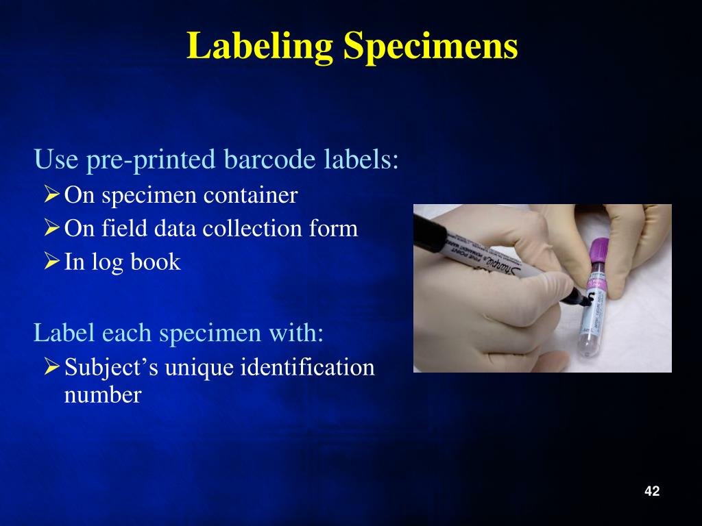 PPT Laboratory Diagnostics, Specimen Collection, and Biosafety Issues