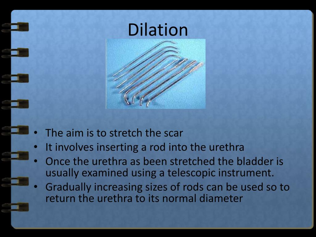 PPT More Than Meets the UTI PowerPoint Presentation, free download