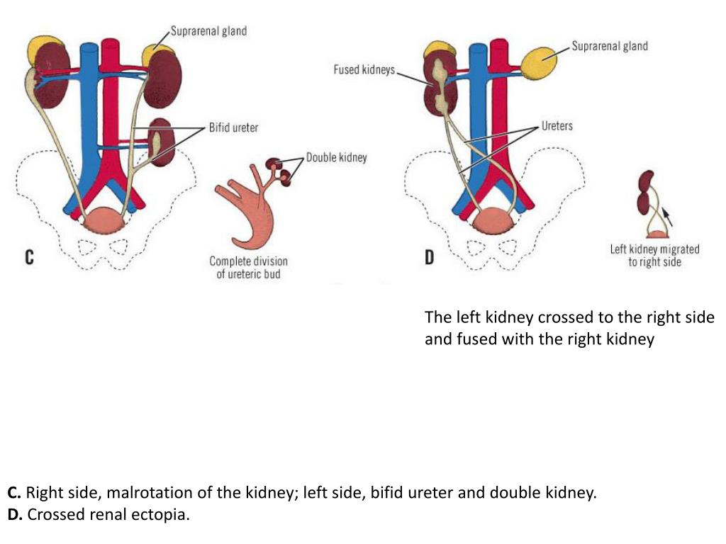 PPT Embryogenesis of the Kidneys and Ureters PowerPoint Presentation
