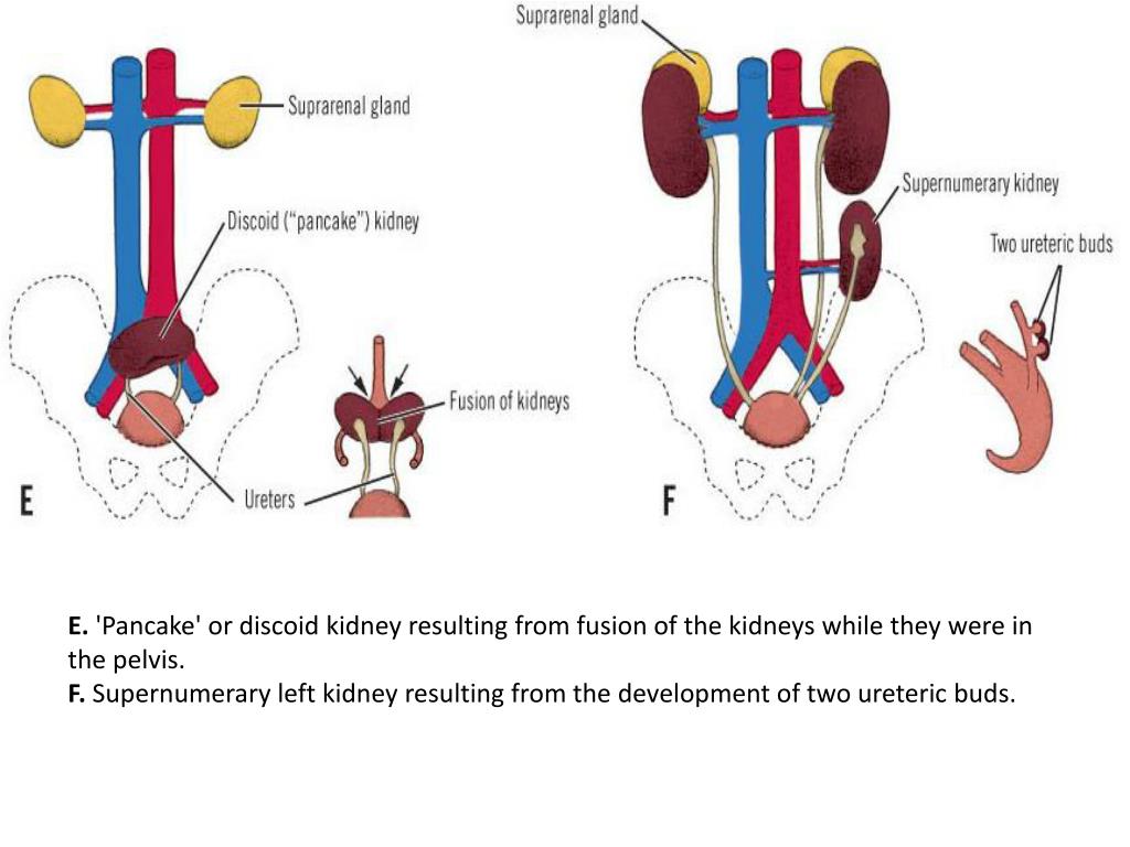 PPT Embryogenesis of the Kidneys and Ureters PowerPoint Presentation
