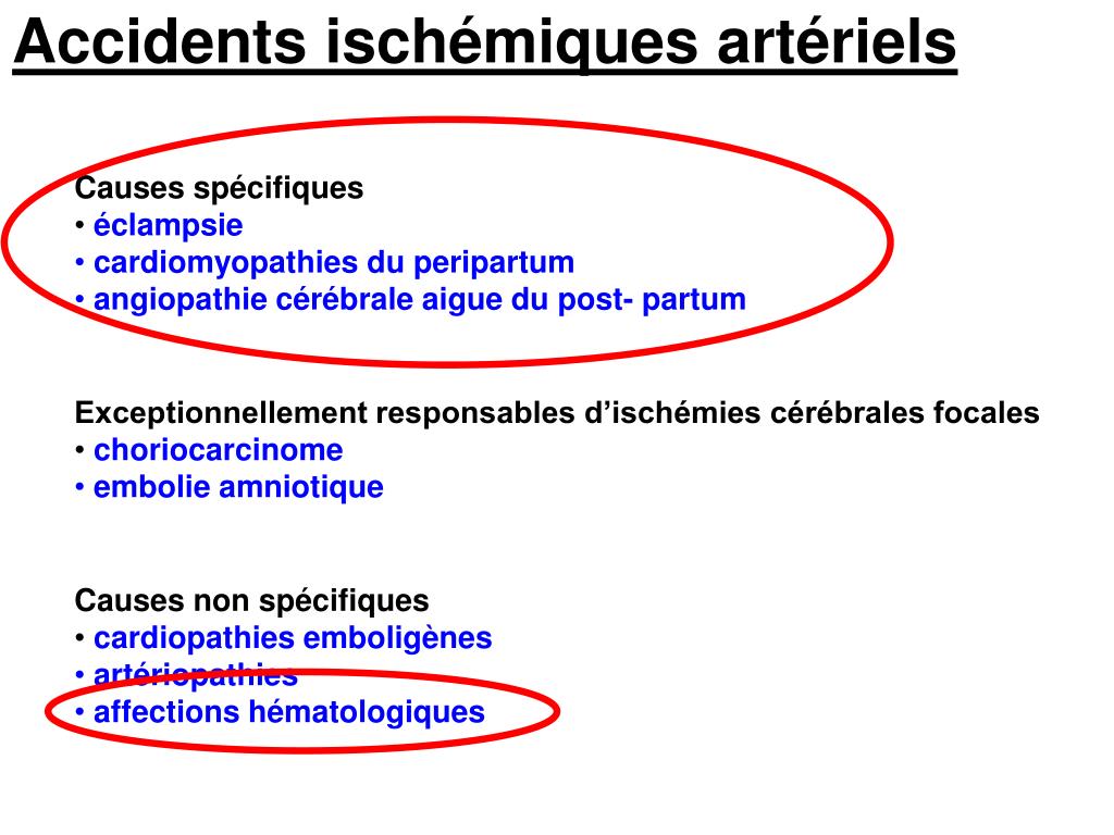 PPT Accidents vasculaires cérébraux de la grossesse et du postpartum PowerPoint Presentation