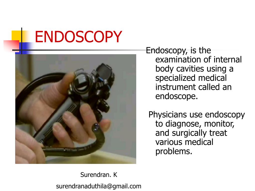 PPT ENDOSCOPY PowerPoint Presentation, free download ID527805