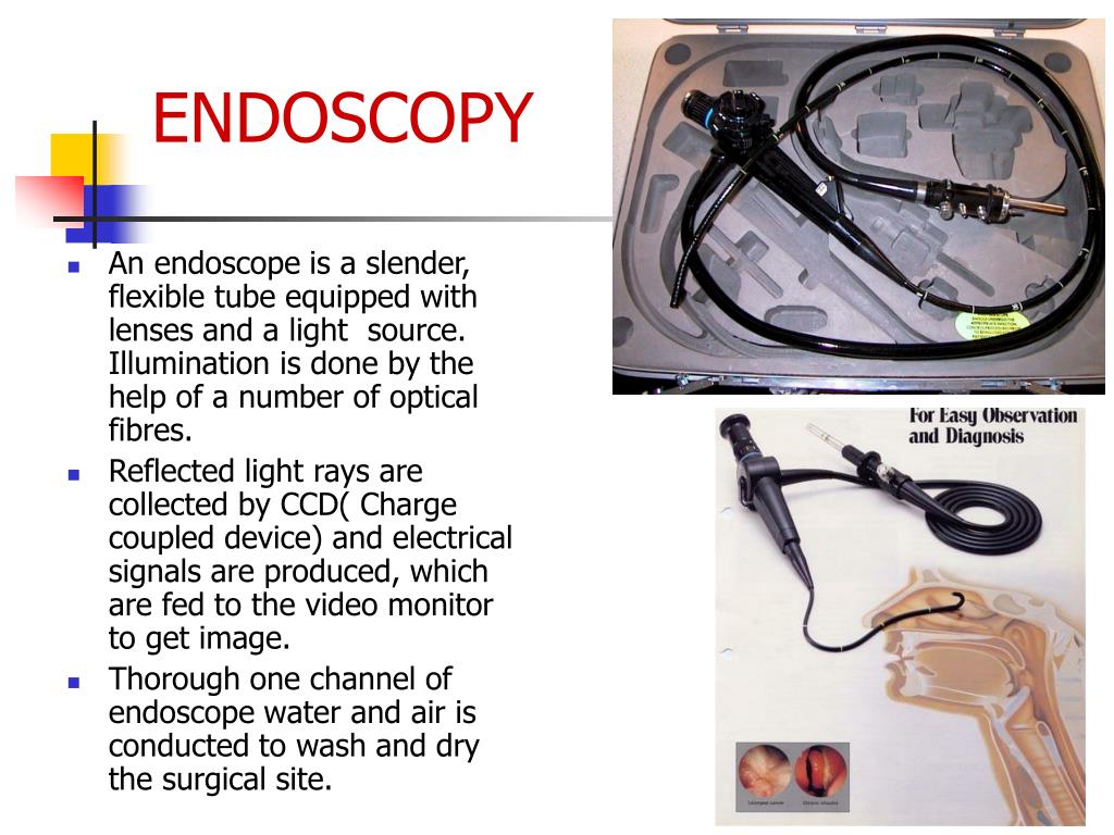 PPT ENDOSCOPY PowerPoint Presentation, free download ID527805